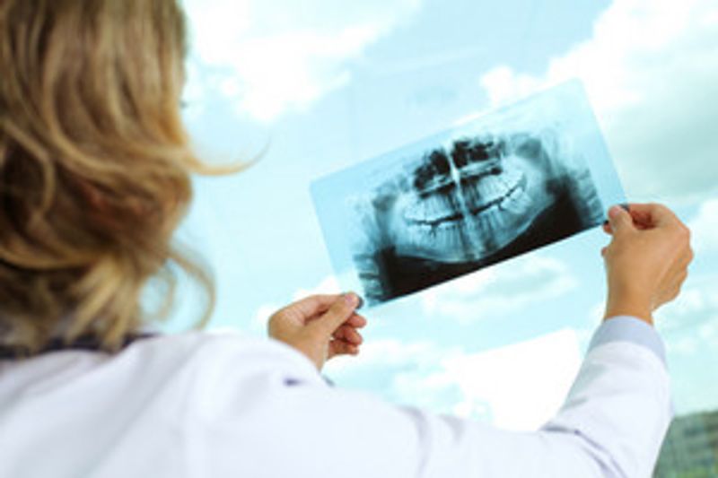 dental implantation near me in Pearcy 71964
